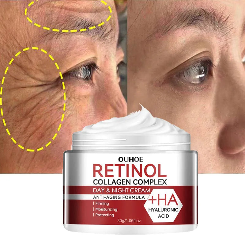 Creme Retinol é anti envelhecimento age na remoção de rugas e na hidratação da pele.
