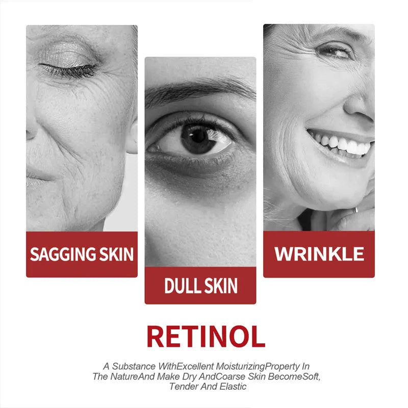 Creme Retinol é anti envelhecimento age na remoção de rugas e na hidratação da pele.
